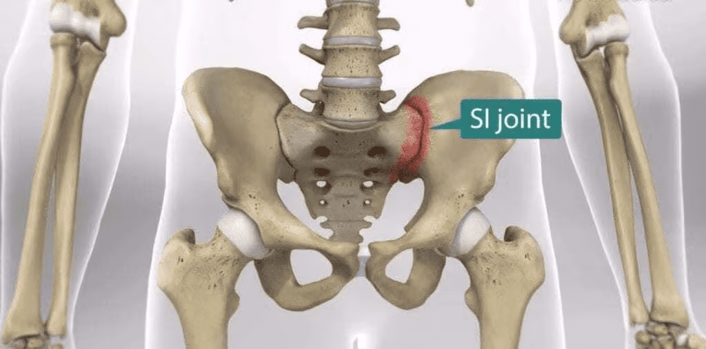 SI Joint Instability